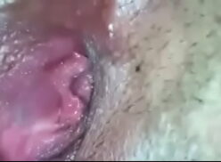 vagina operada